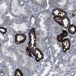 Invitrogen CDH22 Polyclonal Antibody 100 &mu;L; Unconjugated:Antibodies,