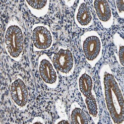 Invitrogen INPP5A Polyclonal Antibody 100 &mu;L; Unconjugated:Antibodies,