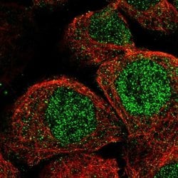 Invitrogen CCRN4L Polyclonal Antibody 100 &mu;L; Unconjugated:Antibodies,