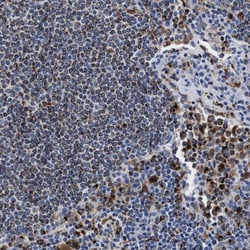 Invitrogen HLA-DMB Polyclonal Antibody 100 &mu;L; Unconjugated:Antibodies,