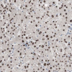 Invitrogen PHTF2 Polyclonal Antibody 100 &mu;L; Unconjugated:Antibodies,