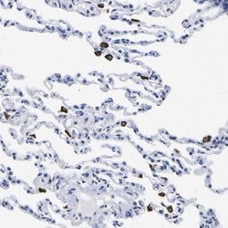 Invitrogen HLA-DQA1 Polyclonal Antibody 100 &mu;L; Unconjugated:Antibodies,