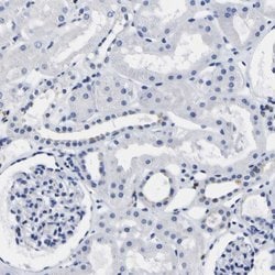 Invitrogen HLA-DQA1 Polyclonal Antibody 100 &mu;L; Unconjugated:Antibodies,