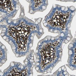 GRAMD1C Polyclonal Antibody:Antibodies, Polyclonal
