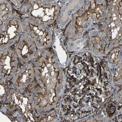 GRAMD1C Polyclonal Antibody:Antibodies, Polyclonal