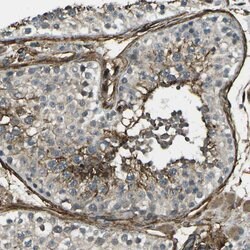 GRAMD1C Polyclonal Antibody:Antibodies, Polyclonal