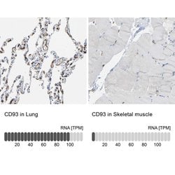 Invitrogen CD93 Polyclonal Antibody 100 &mu;L; Unconjugated:Antibodies,
