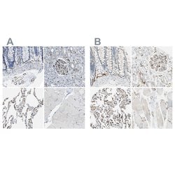 Invitrogen CD93 Polyclonal Antibody 100 &mu;L; Unconjugated:Antibodies,
