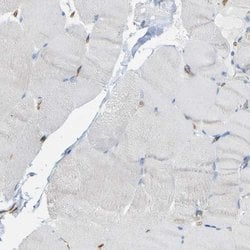 Invitrogen CD93 Polyclonal Antibody 100 &mu;L; Unconjugated:Antibodies,