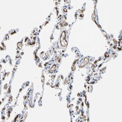 Invitrogen CD93 Polyclonal Antibody 100 &mu;L; Unconjugated:Antibodies,