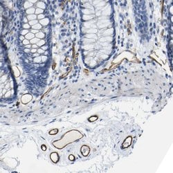 Invitrogen CD93 Polyclonal Antibody 100 &mu;L; Unconjugated:Antibodies,