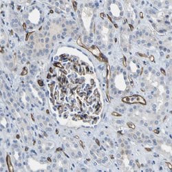 Invitrogen CD93 Polyclonal Antibody 100 &mu;L; Unconjugated:Antibodies,