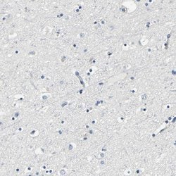 Invitrogen FMO5 Polyclonal Antibody 100 &mu;L; Unconjugated:Antibodies,