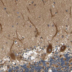 Invitrogen LRCH3 Polyclonal Antibody 100 &mu;L; Unconjugated:Antibodies,