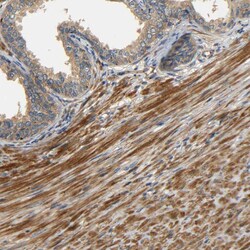Invitrogen LRCH3 Polyclonal Antibody 100 &mu;L; Unconjugated:Antibodies,