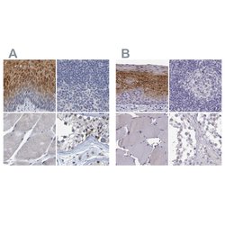 Invitrogen PP11 Polyclonal Antibody 100 &mu;L; Unconjugated:Antibodies,