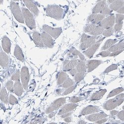Invitrogen PP11 Polyclonal Antibody 100 &mu;L; Unconjugated:Antibodies,