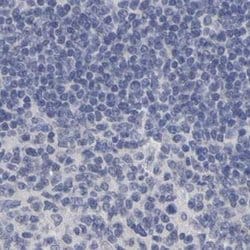 Invitrogen PP11 Polyclonal Antibody 100 &mu;L; Unconjugated:Antibodies,