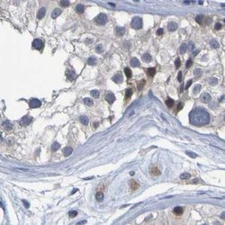 Invitrogen PP11 Polyclonal Antibody 100 &mu;L; Unconjugated:Antibodies,