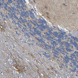 Invitrogen OTOF Polyclonal Antibody 100 &mu;L; Unconjugated:Antibodies,