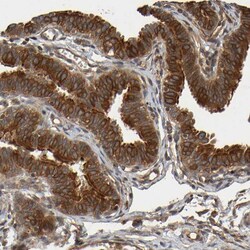 Invitrogen OCRL Polyclonal Antibody 100 &mu;L; Unconjugated:Antibodies,