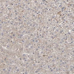 Invitrogen OCRL Polyclonal Antibody 100 &mu;L; Unconjugated:Antibodies,
