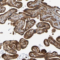 Invitrogen OCRL Polyclonal Antibody 100 &mu;L; Unconjugated:Antibodies,