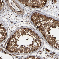 Invitrogen OCRL Polyclonal Antibody 100 &mu;L; Unconjugated:Antibodies,