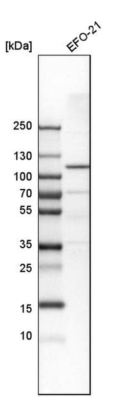 Invitrogen OCRL Polyclonal Antibody 100 &mu;L; Unconjugated:Antibodies,