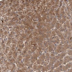 Invitrogen FBP1/FBP2 Polyclonal Antibody 100 &mu;L; Unconjugated:Antibodies,