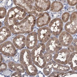 Invitrogen FBP1/FBP2 Polyclonal Antibody 100 &mu;L; Unconjugated:Antibodies,