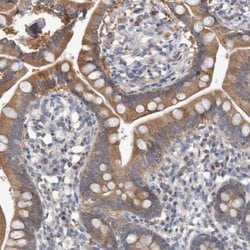 Invitrogen FBP1/FBP2 Polyclonal Antibody 100 &mu;L; Unconjugated:Antibodies,