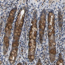Invitrogen C6orf89 Polyclonal Antibody 100 &mu;L; Unconjugated:Antibodies,