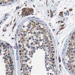 Invitrogen C6orf89 Polyclonal Antibody 100 &mu;L; Unconjugated:Antibodies,