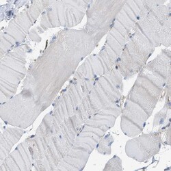 Invitrogen BTN3A1 Polyclonal Antibody 100 &mu;L; Unconjugated:Antibodies,