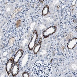 Invitrogen GRAMD1A Polyclonal Antibody 100 &mu;L; Unconjugated:Antibodies,