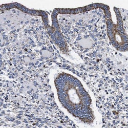 Invitrogen FKBP9 Polyclonal Antibody 100 &mu;L; Unconjugated:Antibodies,