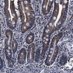 Invitrogen FKBP9 Polyclonal Antibody 100 &mu;L; Unconjugated:Antibodies,