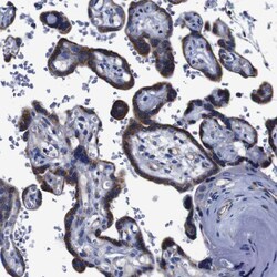 Invitrogen FKBP9 Polyclonal Antibody 100 &mu;L; Unconjugated:Antibodies,