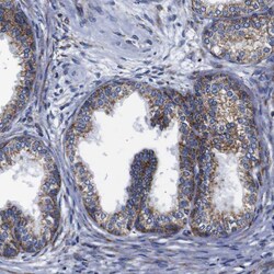 Invitrogen FKBP9 Polyclonal Antibody 100 &mu;L; Unconjugated:Antibodies,