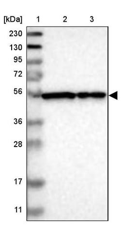 Invitrogen FKBP9 Polyclonal Antibody 100 &mu;L; Unconjugated:Antibodies,