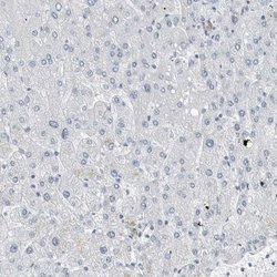 Invitrogen FABP6 Polyclonal Antibody 100 &mu;L; Unconjugated:Anticuerpos