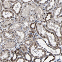 Invitrogen Carbonic Anhydrase VB Polyclonal Antibody 100 &mu;L; Unconjugated:Antibodies,