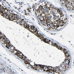 Invitrogen Carbonic Anhydrase VB Polyclonal Antibody 100 &mu;L; Unconjugated:Antibodies,