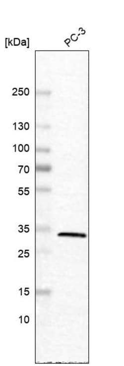 Invitrogen Carbonic Anhydrase VB Polyclonal Antibody 100 &mu;L; Unconjugated:Antibodies,