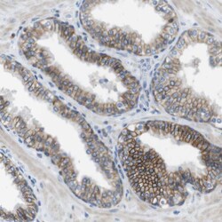 Invitrogen CLMN Polyclonal Antibody 100 &mu;L; Unconjugated:Antibodies,