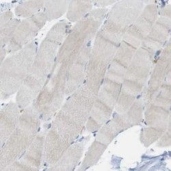 Invitrogen CLMN Polyclonal Antibody 100 &mu;L; Unconjugated:Antibodies,