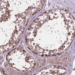 Invitrogen MTH1 Polyclonal Antibody 100 &mu;L; Unconjugated:Antibodies,