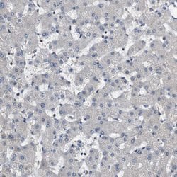 Invitrogen GALNT8 Polyclonal Antibody 100 &mu;L | Buy Online | Invitrogen&trade; | Fisher Scientific