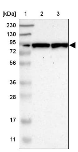Invitrogen GALNT8 Polyclonal Antibody 100 &mu;L | Buy Online | Invitrogen&trade; | Fisher Scientific